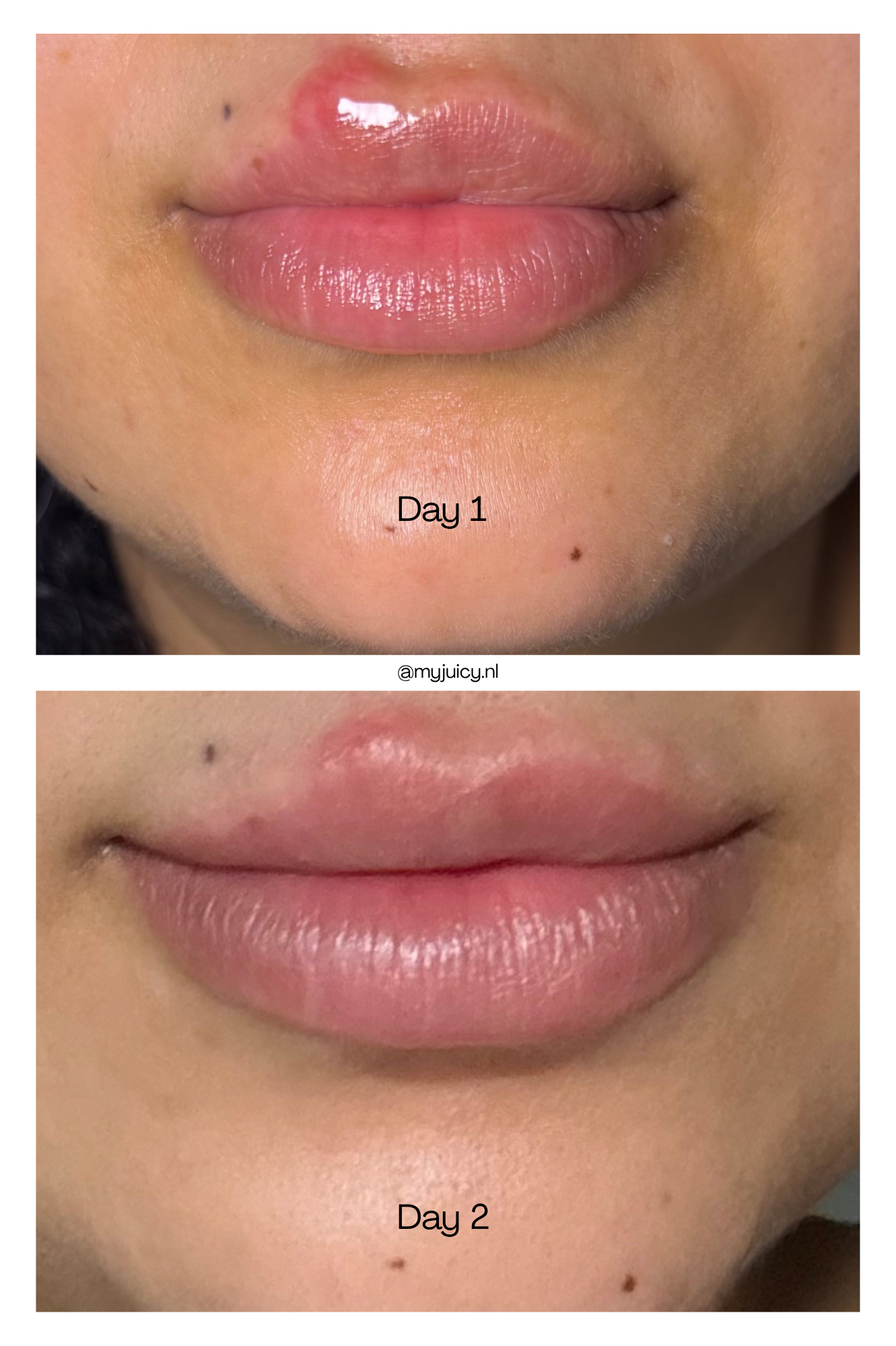 DEEP LIP TREATMENT - RED
