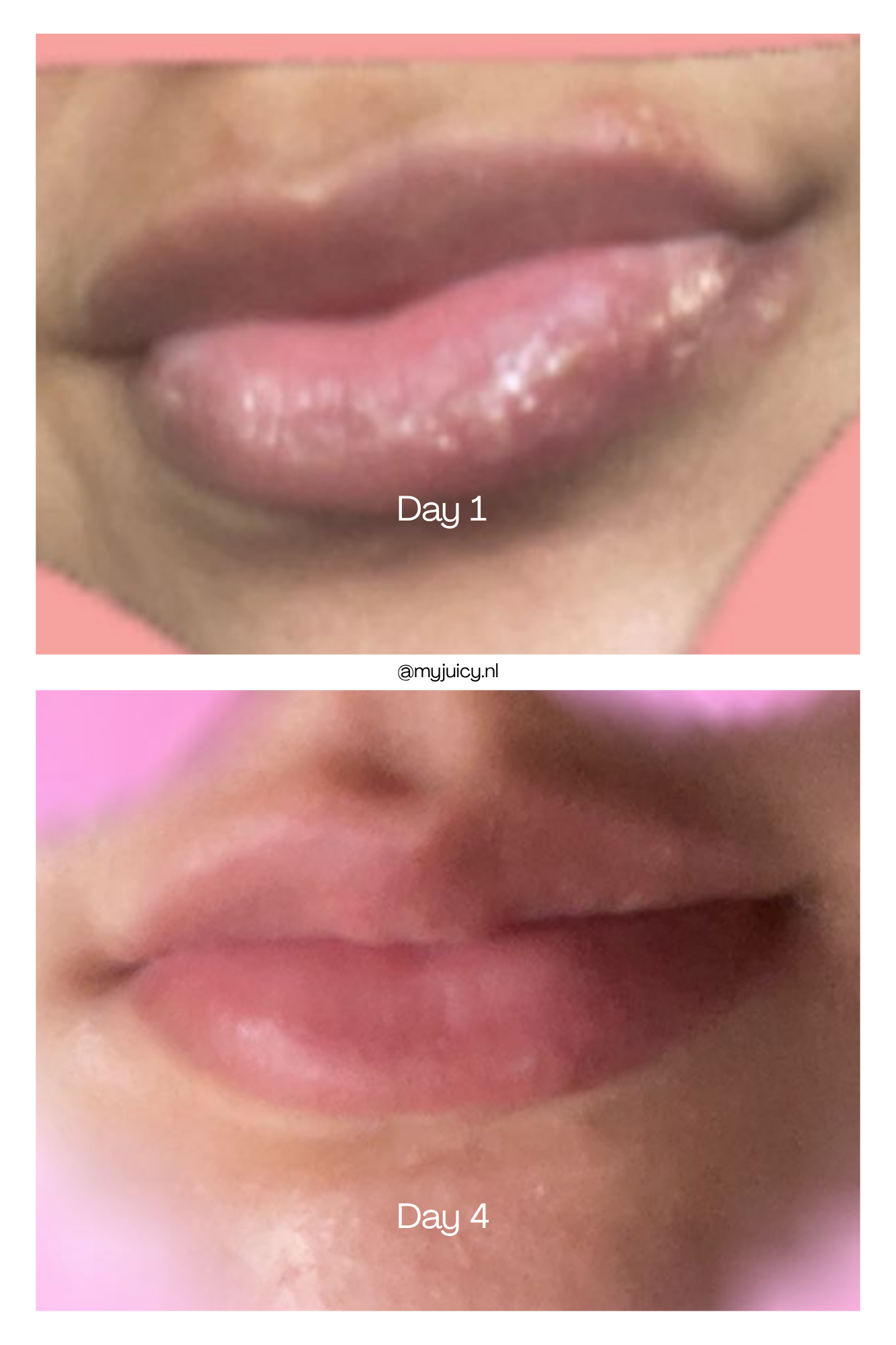 DEEP LIP TREATMENT - RED